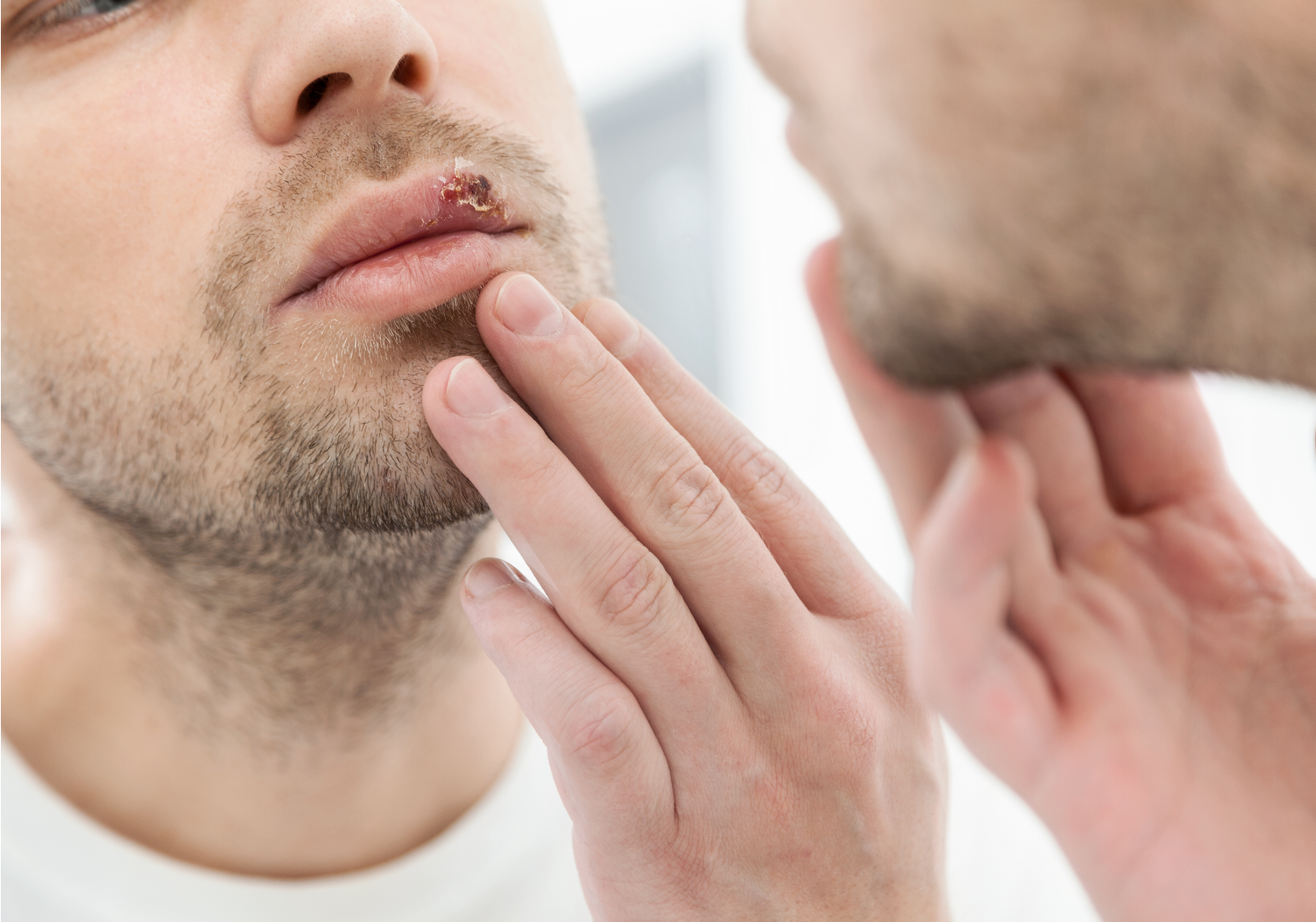 Immer wieder Herpes, Gürtelrose & Co.?